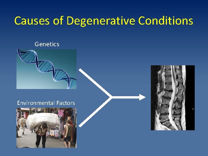 Causes of Degenerative Conditions Genetics Environmental Factors 