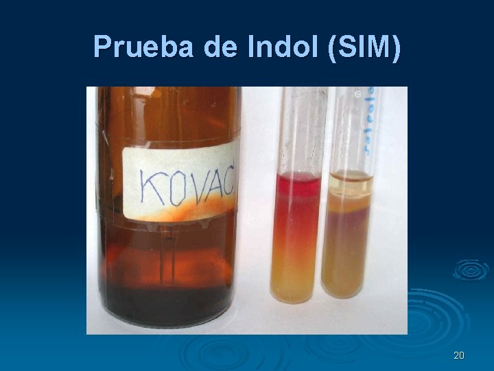 Prueba de Indol (SIM) 20 