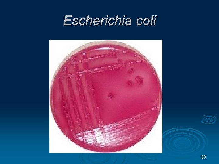 Escherichia coli 30 