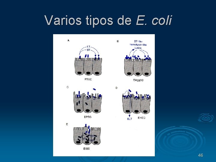 Varios tipos de E. coli 46 