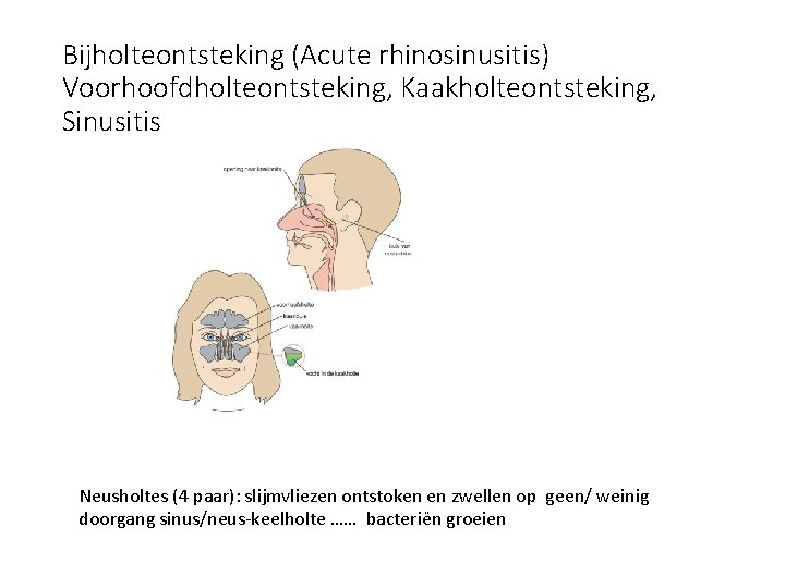 Bijholteontsteking (Acute rhinosinusitis) Voorhoofdholteontsteking, Kaakholteontsteking, Sinusitis Neusholtes (4 paar): slijmvliezen ontstoken en zwellen op