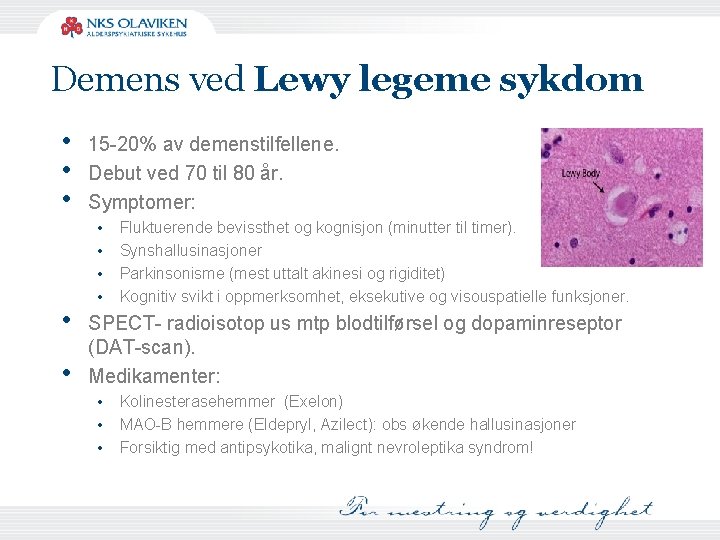 Demens ved Lewy legeme sykdom • • • 15 -20% av demenstilfellene. Debut ved