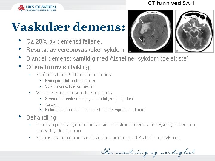 Vaskulær demens: • • Ca 20% av demenstilfellene. Resultat av cerebrovaskulær sykdom Blandet demens: