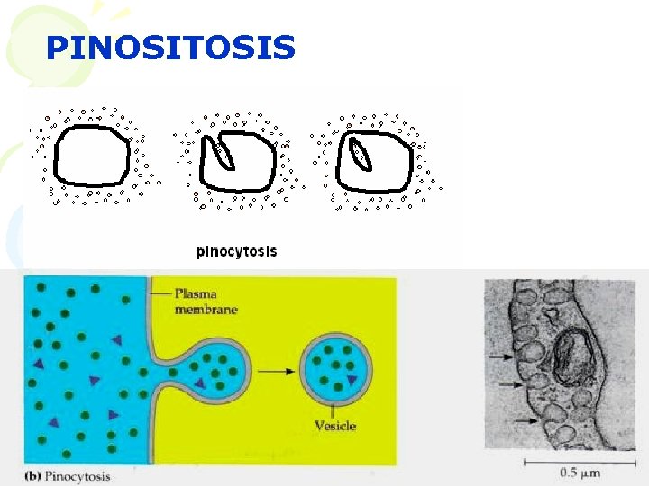 PINOSITOSIS 