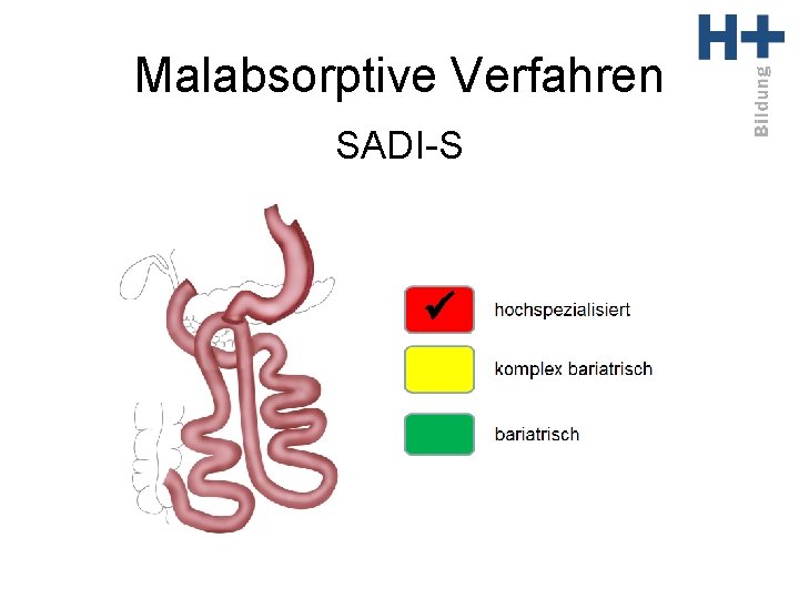 Malabsorptive Verfahren SADI-S ü 