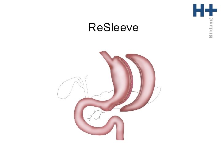 Re. Sleeve 