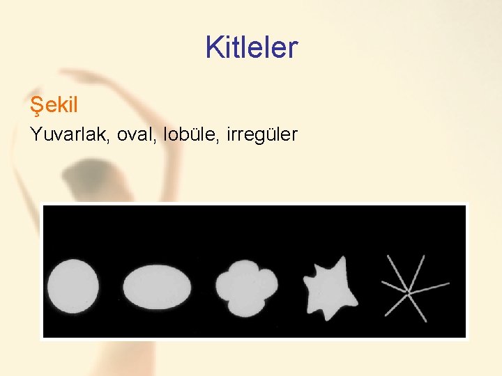 Kitleler Şekil Yuvarlak, oval, lobüle, irregüler 