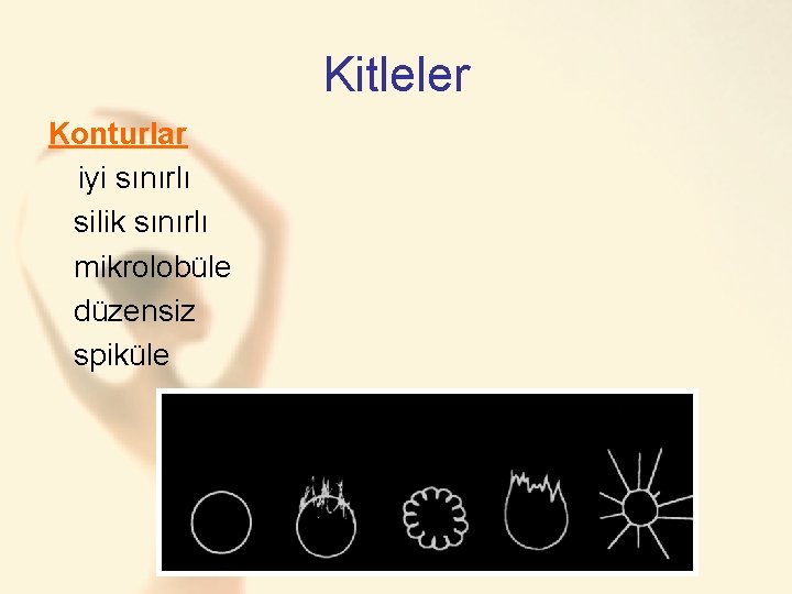 Kitleler Konturlar iyi sınırlı silik sınırlı mikrolobüle düzensiz spiküle 