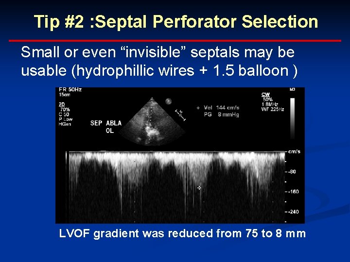 Tip #2 : Septal Perforator Selection Small or even “invisible” septals may be usable