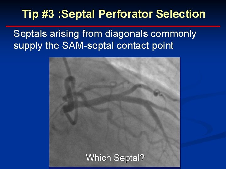 Tip #3 : Septal Perforator Selection Septals arising from diagonals commonly supply the SAM-septal