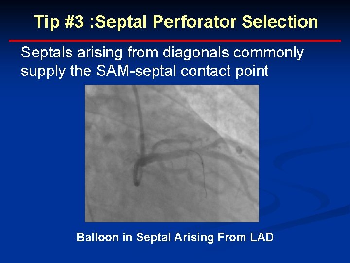 Tip #3 : Septal Perforator Selection Septals arising from diagonals commonly supply the SAM-septal