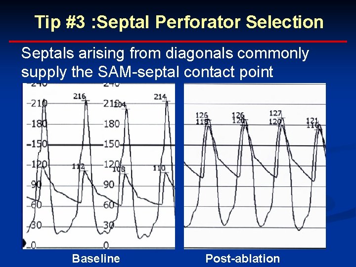 Tip #3 : Septal Perforator Selection Septals arising from diagonals commonly supply the SAM-septal