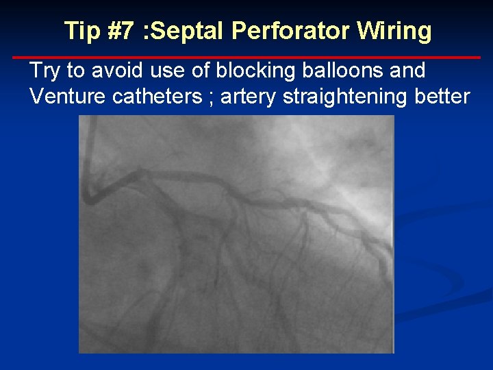 Tip #7 : Septal Perforator Wiring Try to avoid use of blocking balloons and