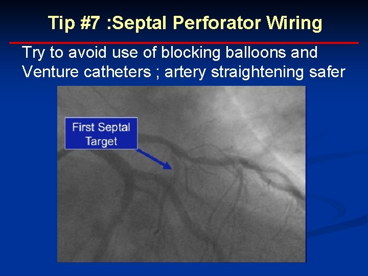 Tip #7 : Septal Perforator Wiring Try to avoid use of blocking balloons and