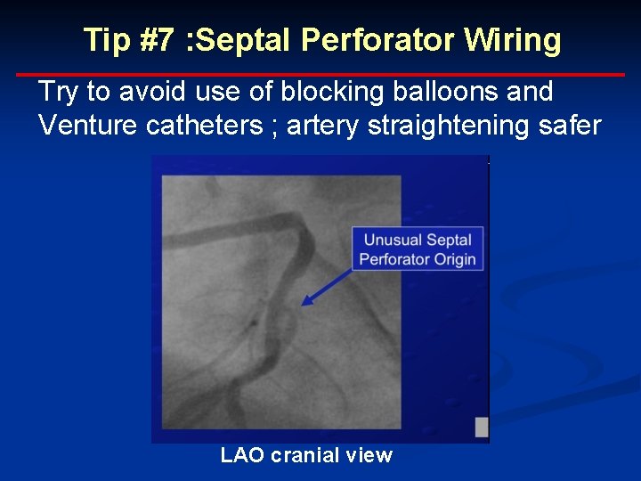 Tip #7 : Septal Perforator Wiring Try to avoid use of blocking balloons and