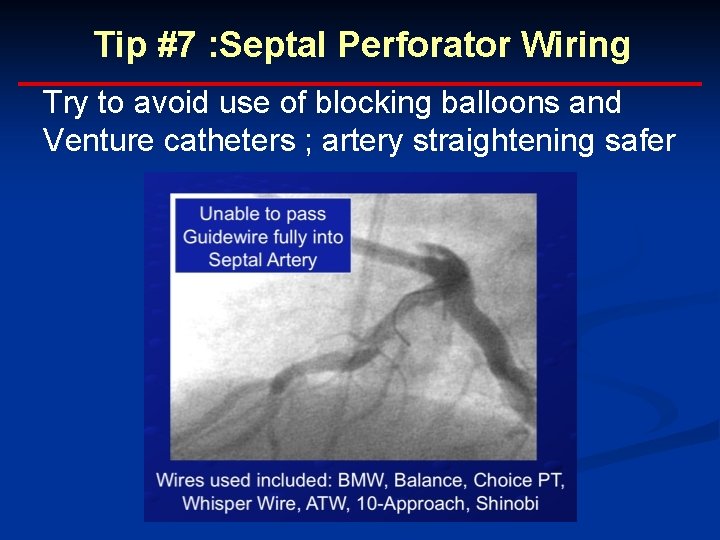 Tip #7 : Septal Perforator Wiring Try to avoid use of blocking balloons and