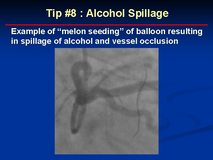 Tip #8 : Alcohol Spillage Example of “melon seeding” of balloon resulting in spillage