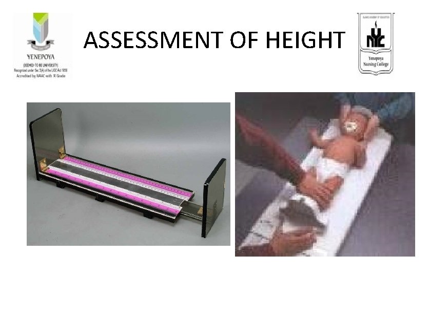 ASSESSMENT OF HEIGHT 