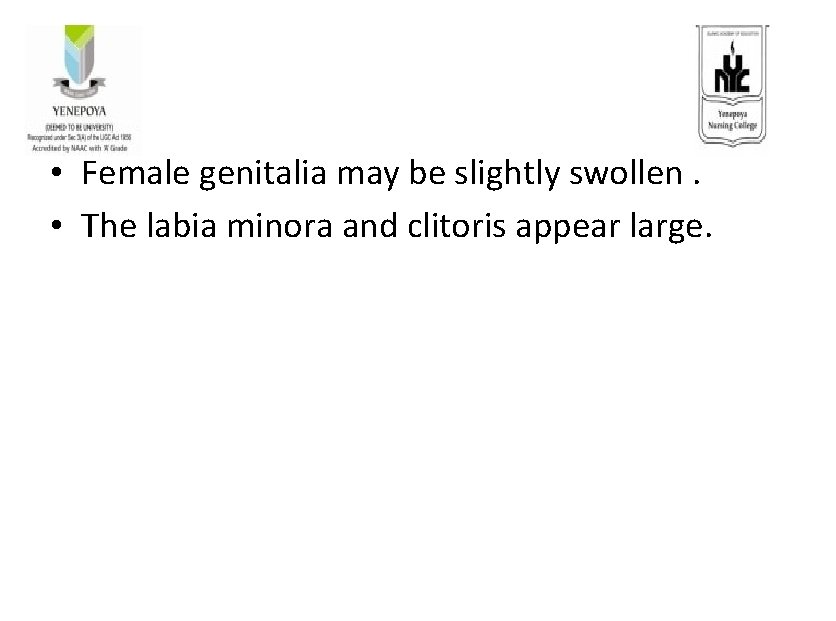  • Female genitalia may be slightly swollen. • The labia minora and clitoris