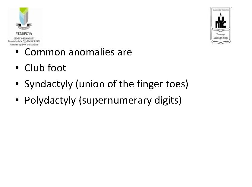  • • Common anomalies are Club foot Syndactyly (union of the finger toes)