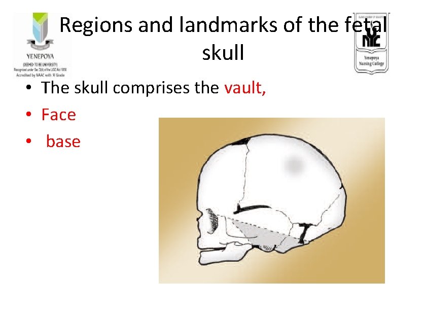 Regions and landmarks of the fetal skull • The skull comprises the vault, •