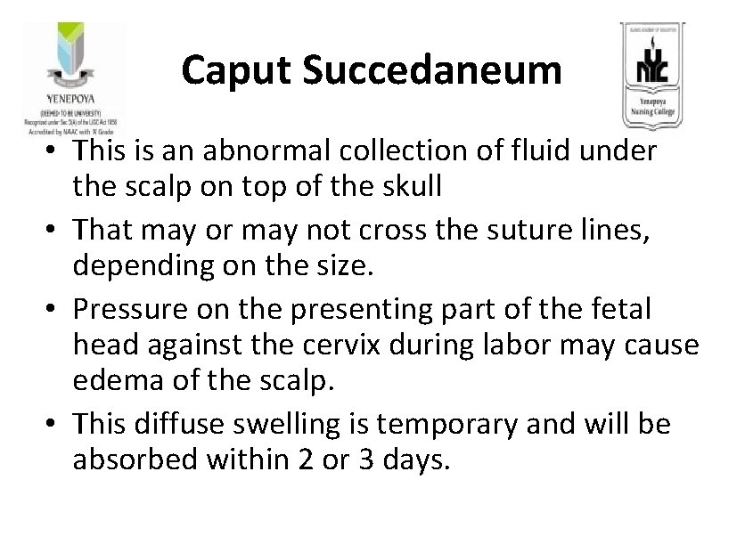 Caput Succedaneum • This is an abnormal collection of fluid under the scalp on