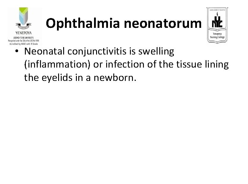 Ophthalmia neonatorum • Neonatal conjunctivitis is swelling (inflammation) or infection of the tissue lining