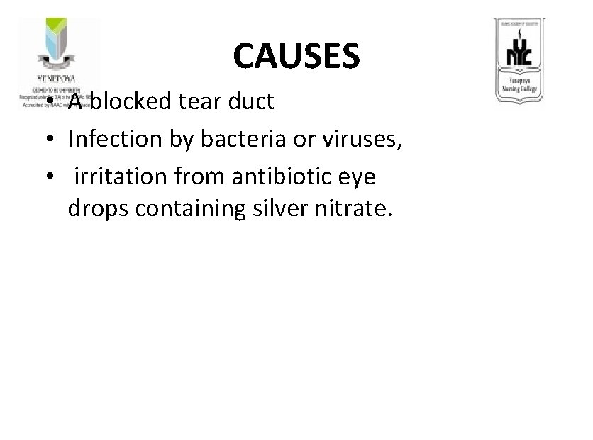 CAUSES • A blocked tear duct • Infection by bacteria or viruses, • irritation