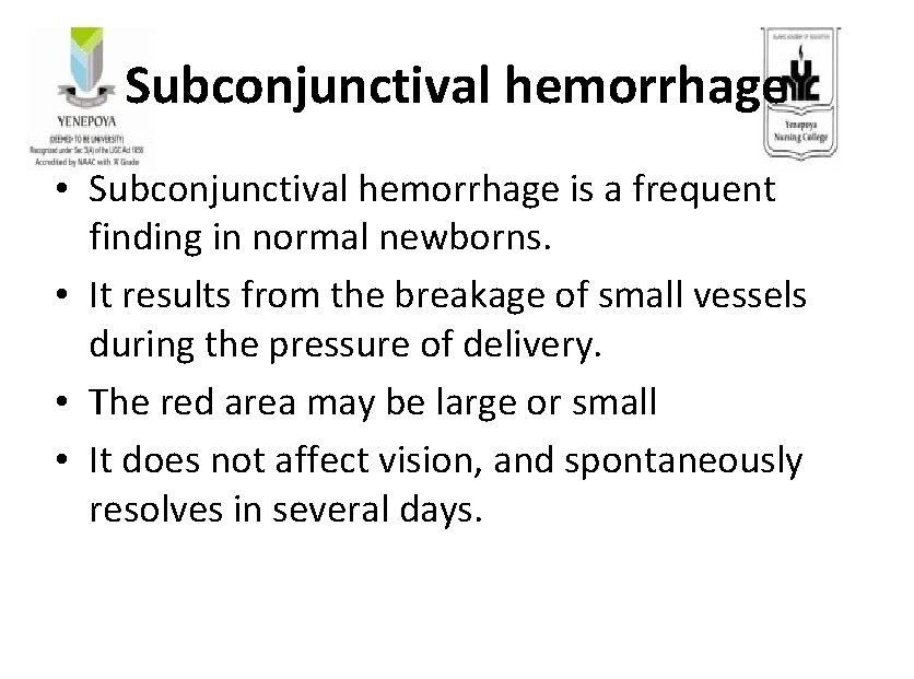 Subconjunctival hemorrhage • Subconjunctival hemorrhage is a frequent finding in normal newborns. • It