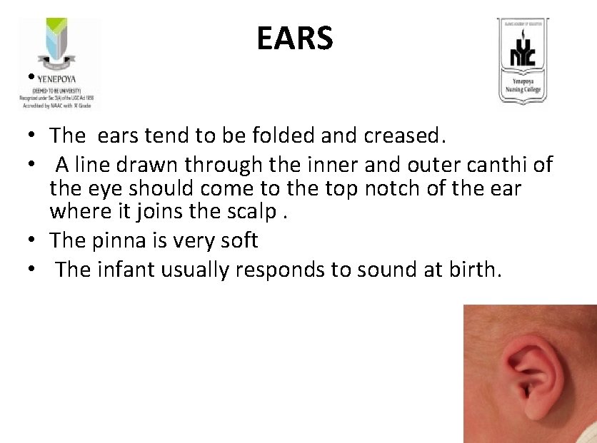 EARS • • The ears tend to be folded and creased. • A line