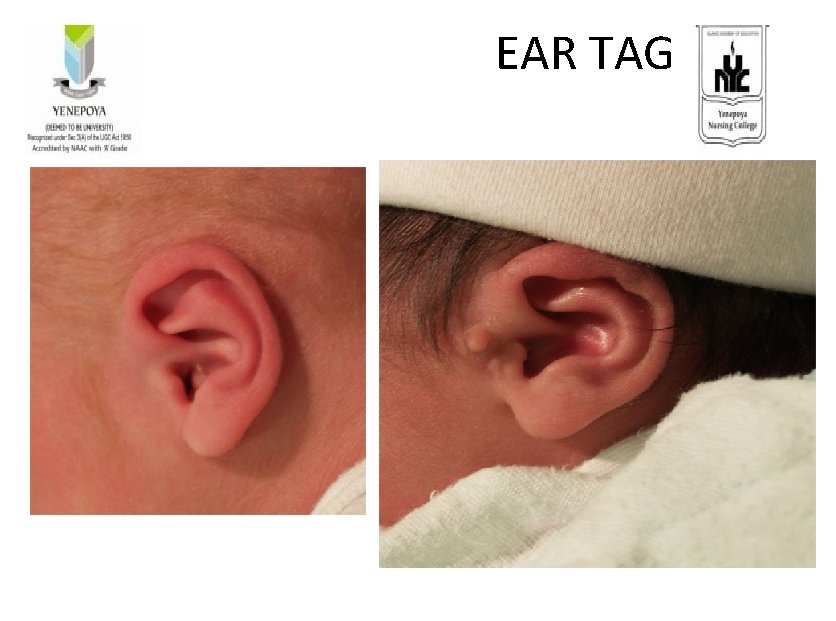  EAR TAG 