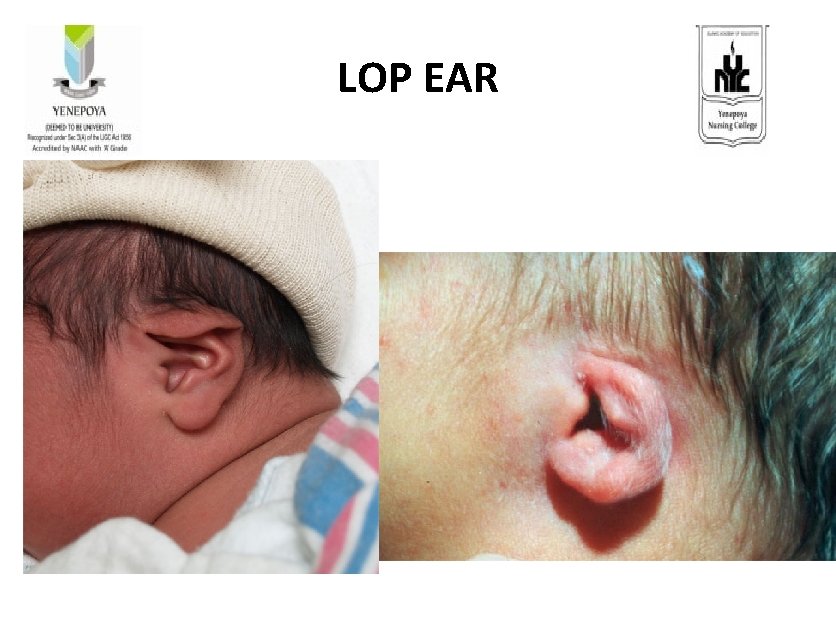 LOP EAR 