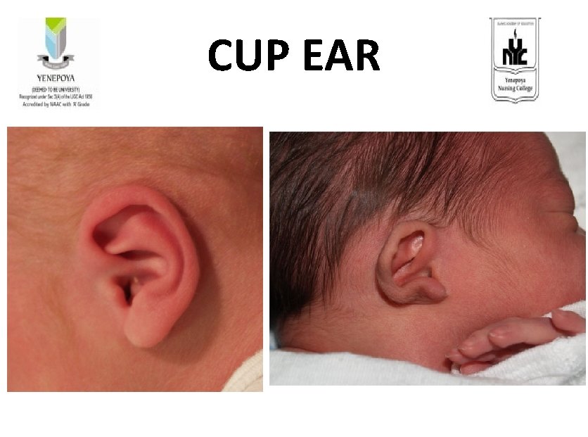 CUP EAR 