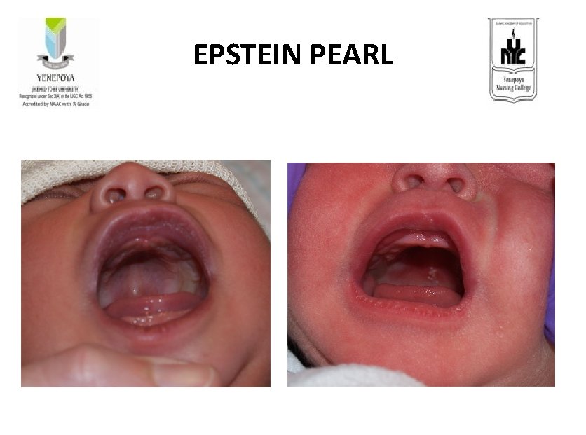 EPSTEIN PEARL 
