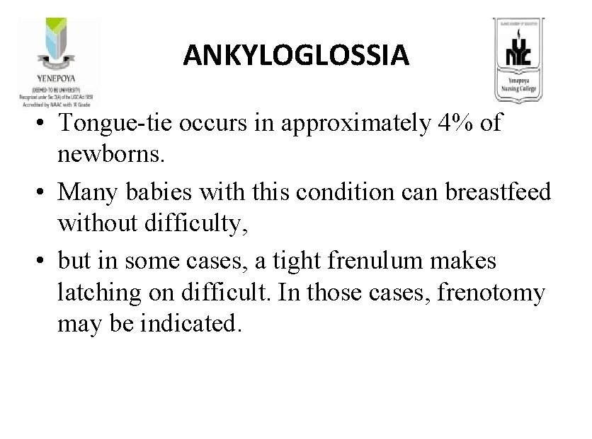 ANKYLOGLOSSIA • Tongue-tie occurs in approximately 4% of newborns. • Many babies with this