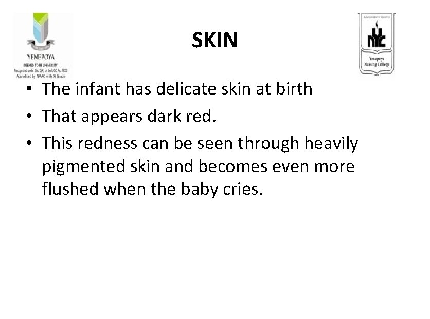  SKIN • The infant has delicate skin at birth • That appears dark