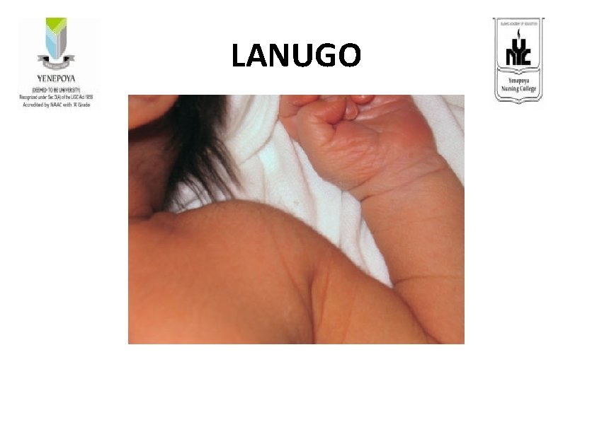 LANUGO 