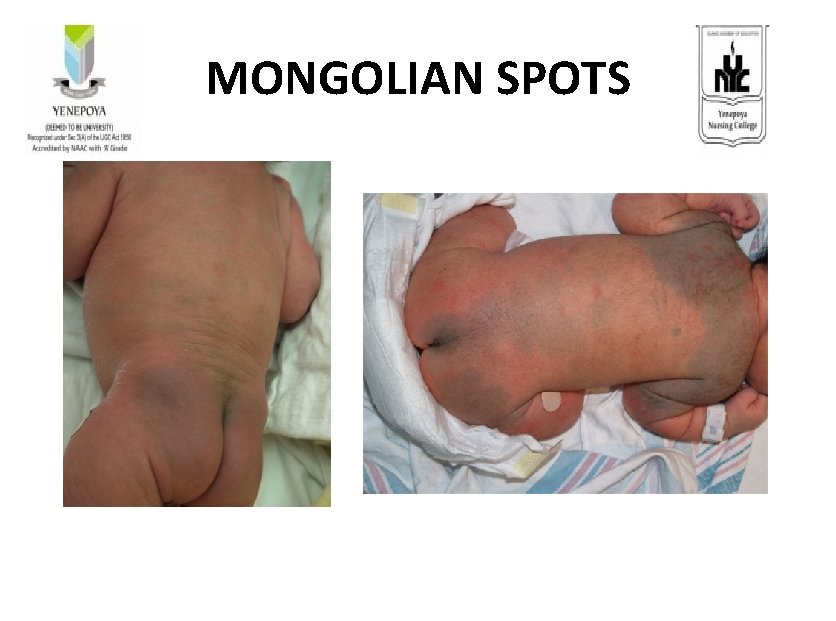 MONGOLIAN SPOTS 