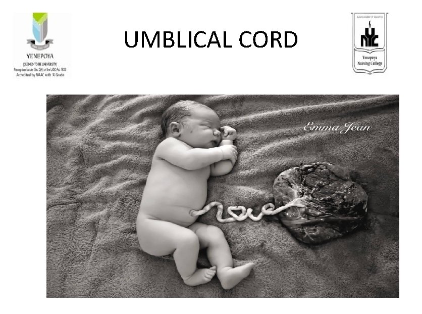 UMBLICAL CORD 