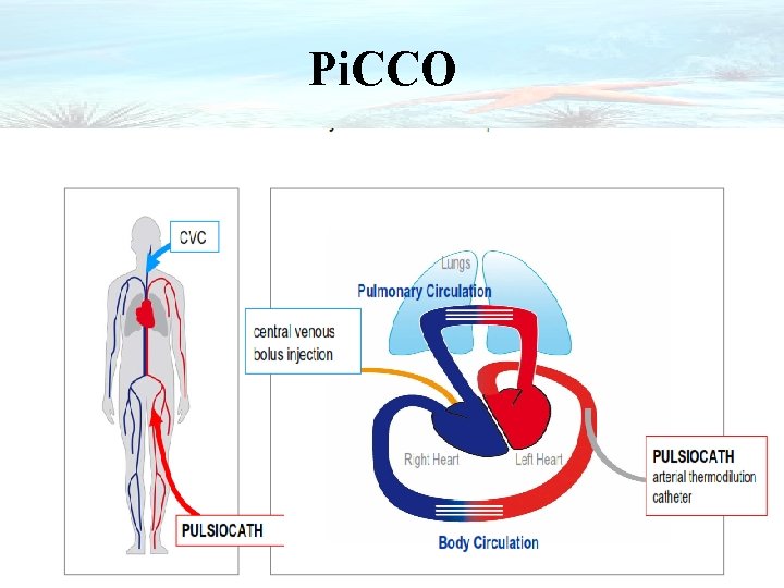 Pi. CCO 