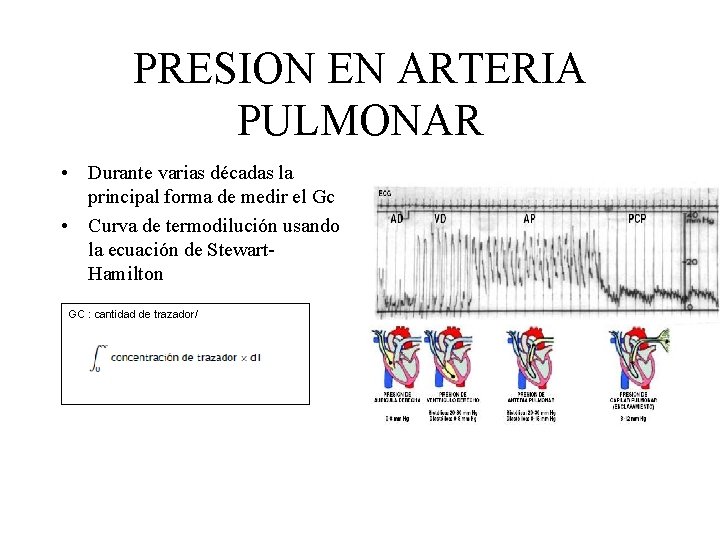 PRESION EN ARTERIA PULMONAR • Durante varias décadas la principal forma de medir el