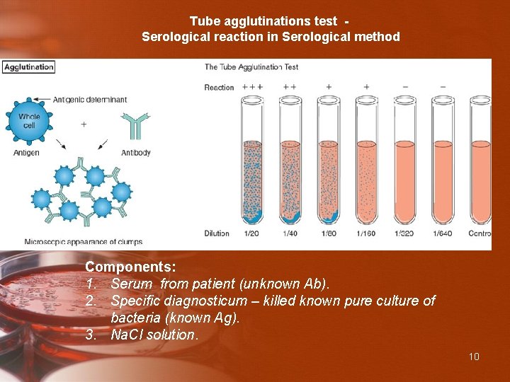 Tube agglutinations test Serological reaction in Serological method Components: 1. Serum from patient (unknown