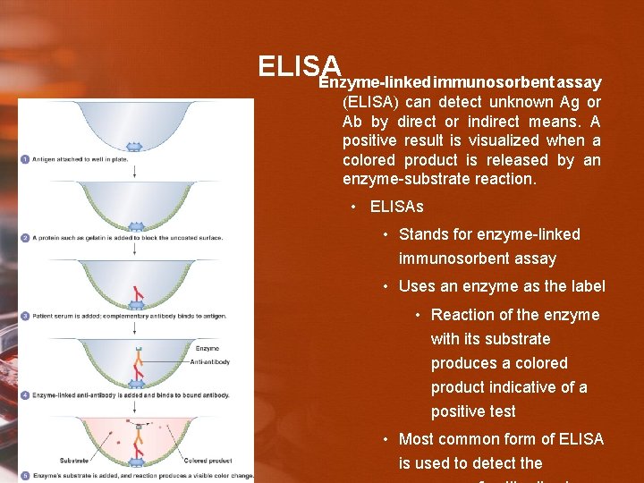 ELISA Enzyme-linked immunosorbent assay (ELISA) can detect unknown Ag or Ab by direct or