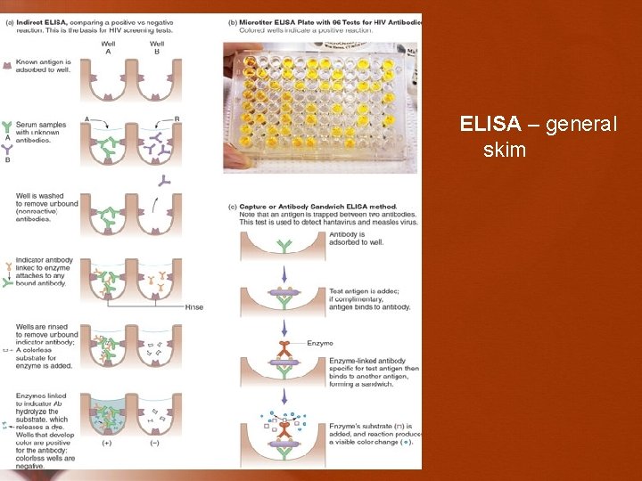 ELISA – general skim 