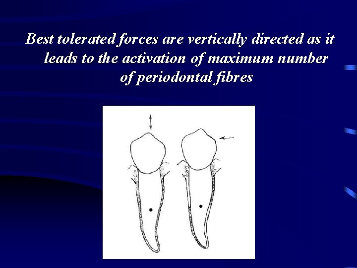 Best tolerated forces are vertically directed as it leads to the activation of maximum