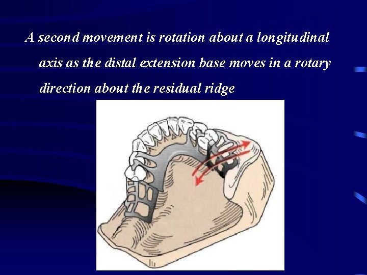 A second movement is rotation about a longitudinal axis as the distal extension base