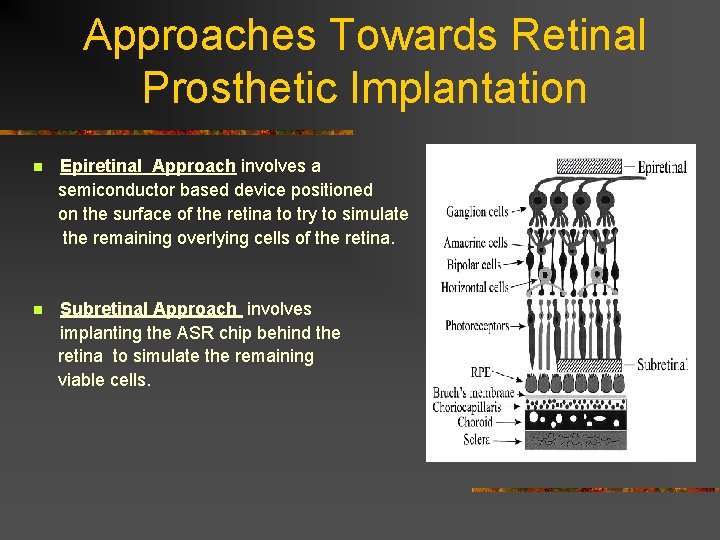 Approaches Towards Retinal Prosthetic Implantation n Epiretinal Approach involves a semiconductor based device positioned