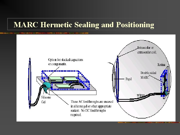 MARC Hermetic Sealing and Positioning 