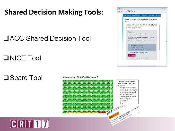 Shared Decision Making Tools: q ACC Shared Decision Tool q NICE Tool q Sparc