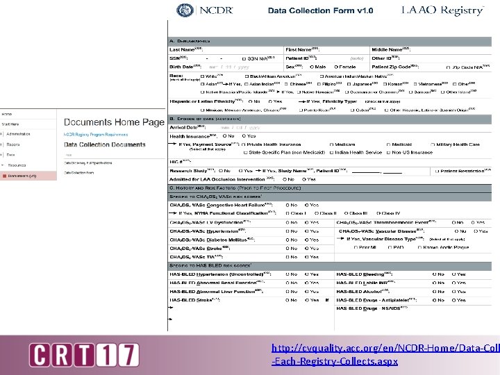 http: //cvquality. acc. org/en/NCDR-Home/Data-Coll -Each-Registry-Collects. aspx 